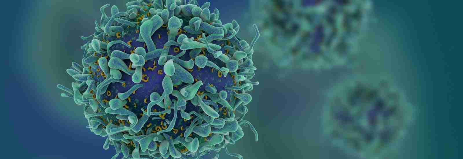 AI has helped scientists reveal a new form of aggressive prostate cancer, which could revolutionise how the disease is diagnosed and treated in the future